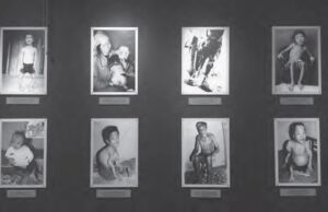 a panel of different photos of people with various dismemberments or disabilities