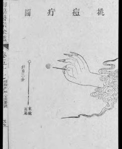 illustration of a hand with a small needle pointed at a target
